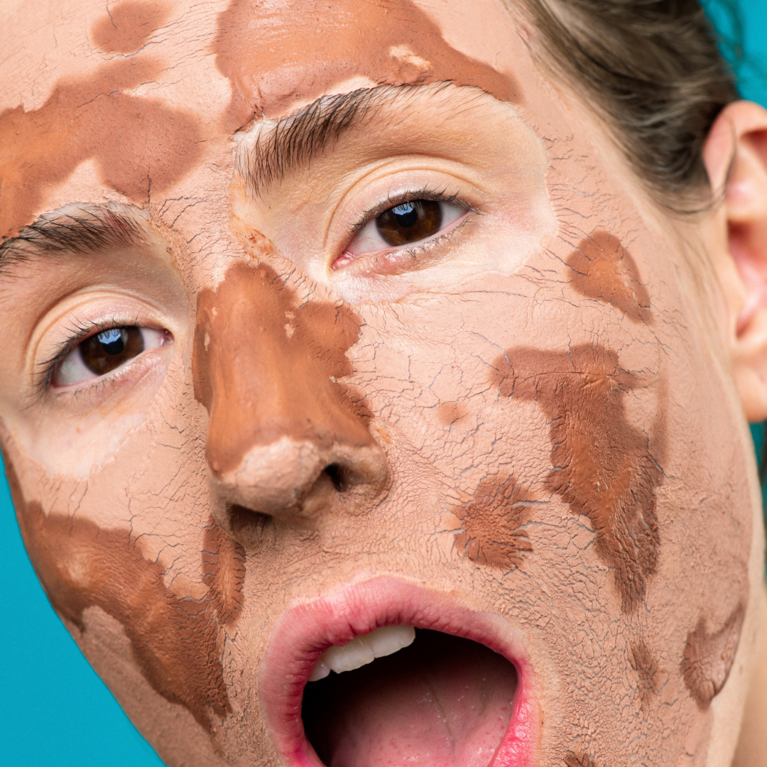 Effective Dry Skin Care Routine: The Ultimate Guide to Hydrating and Treating Dry Skin