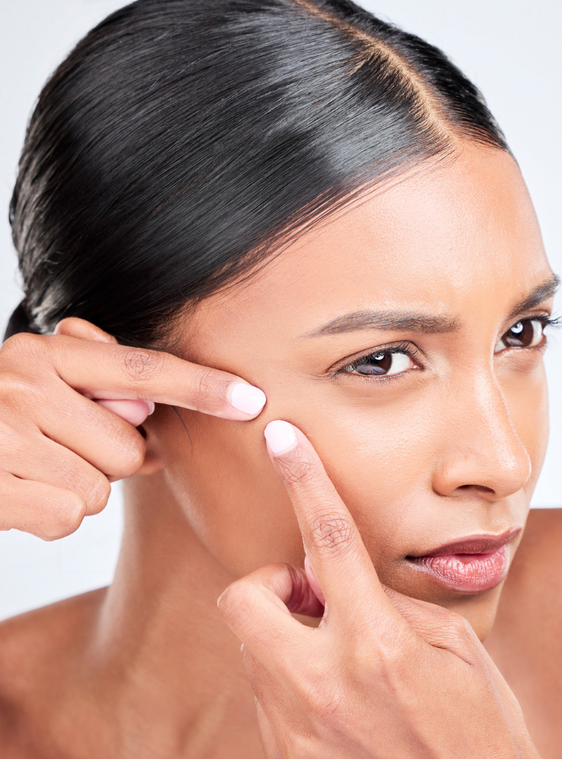 Sensitive Skin: The Ultimate Guide to your sensitive skin type.